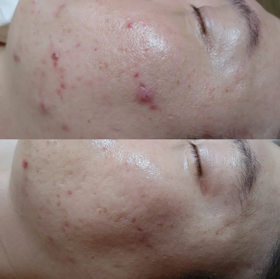 이미지 5