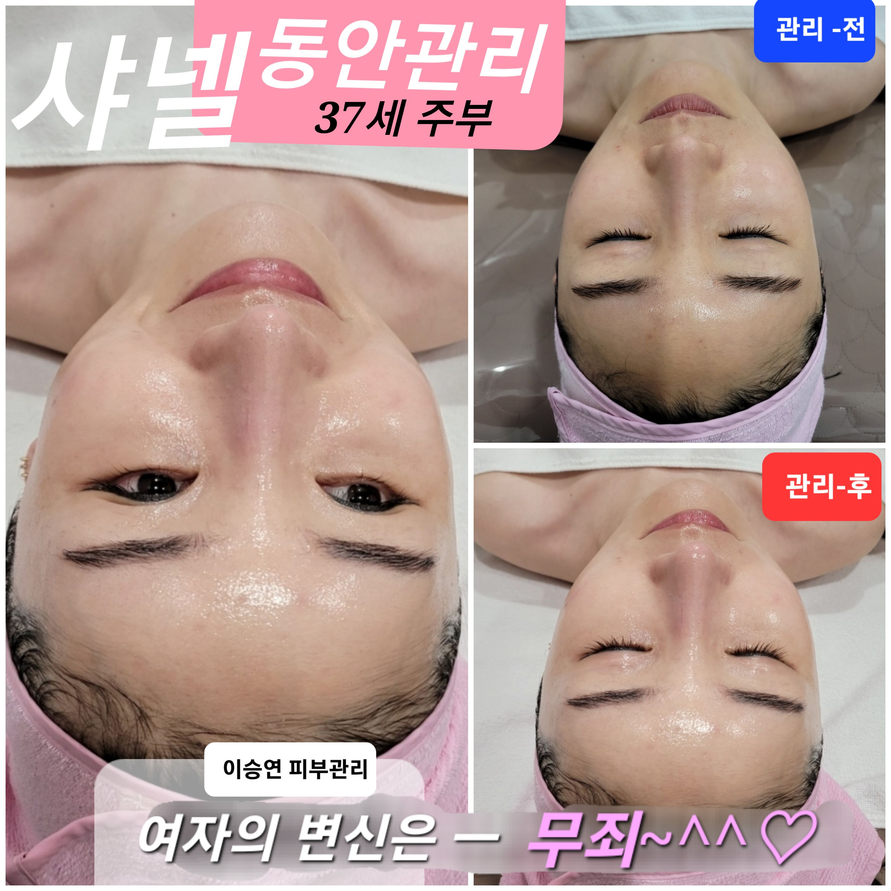 이미지 4