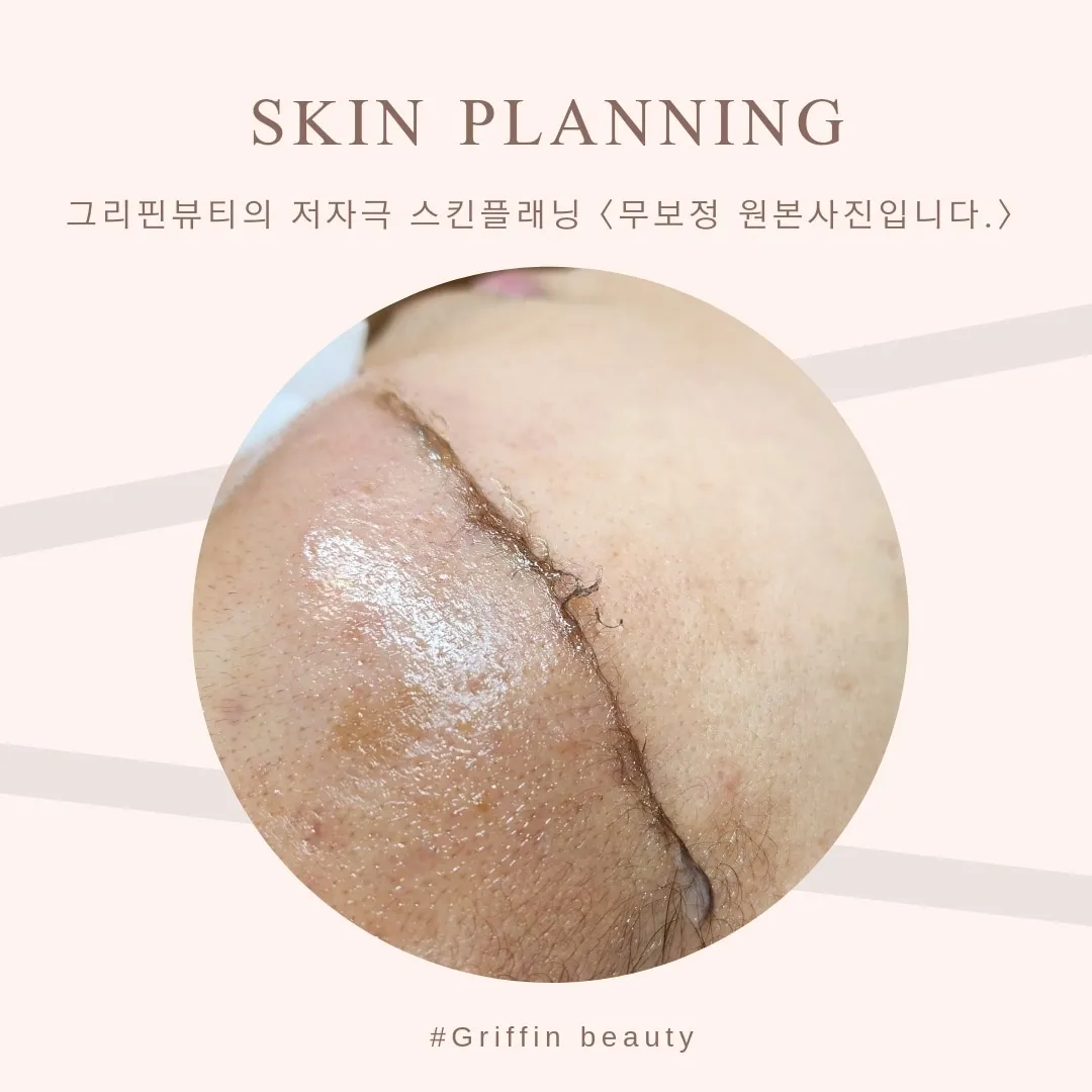 이미지 6