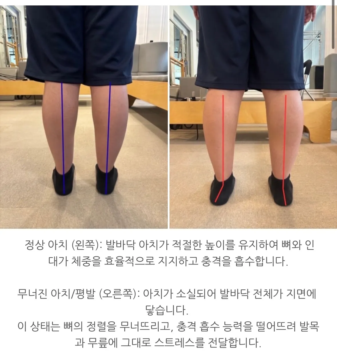 이미지 4