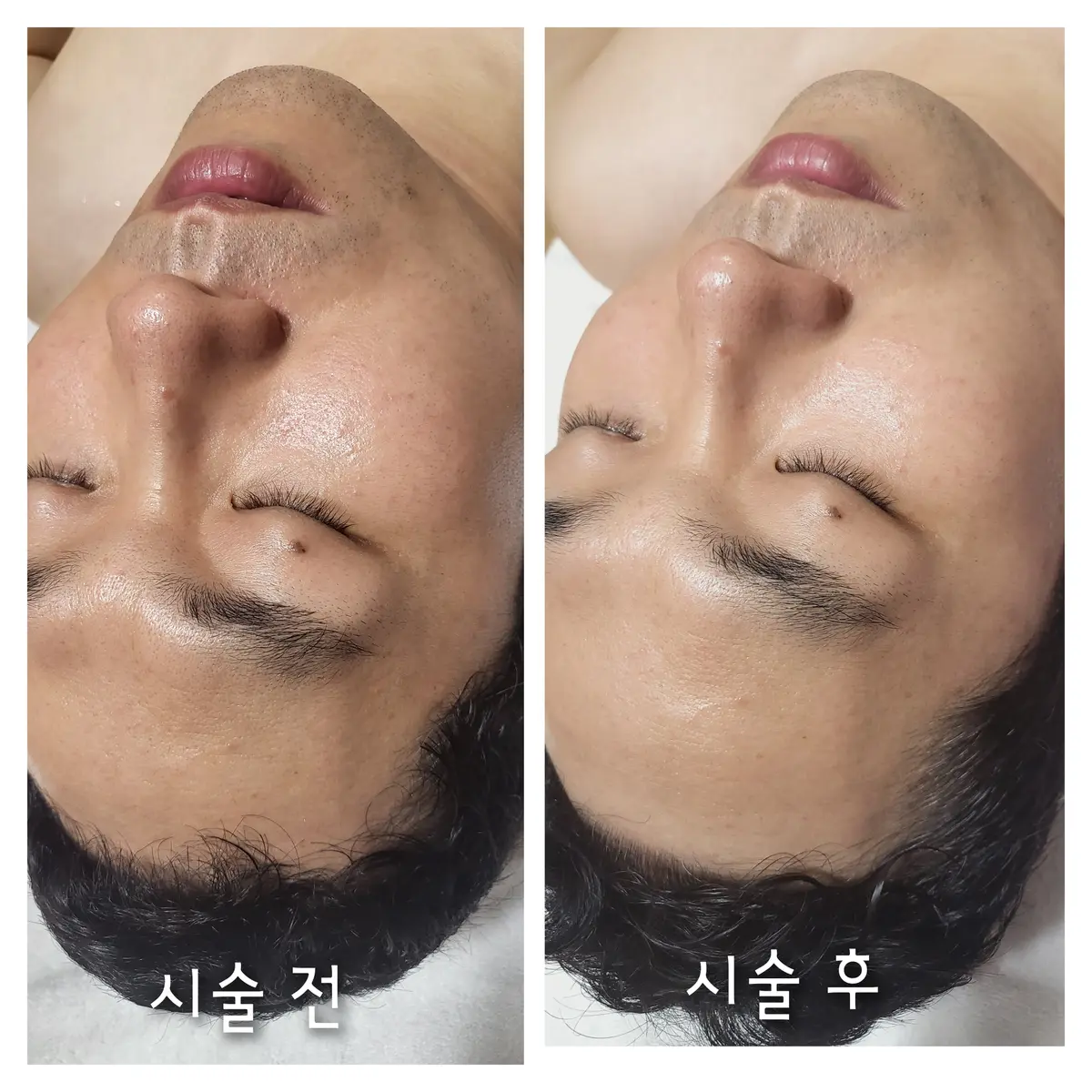 이미지 3