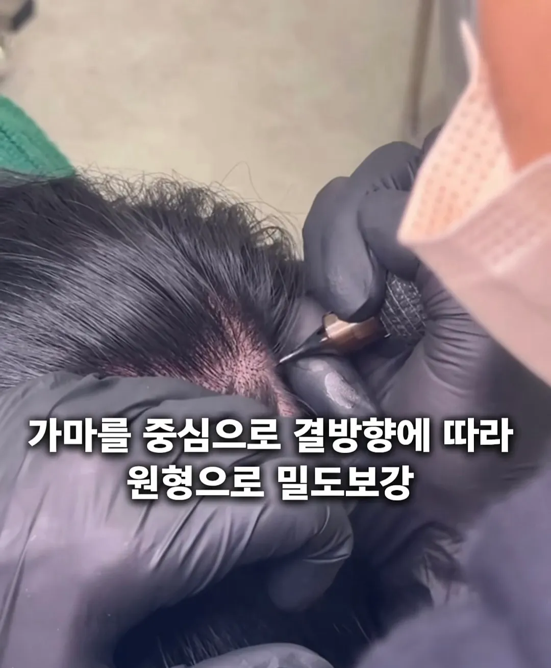 이미지 11