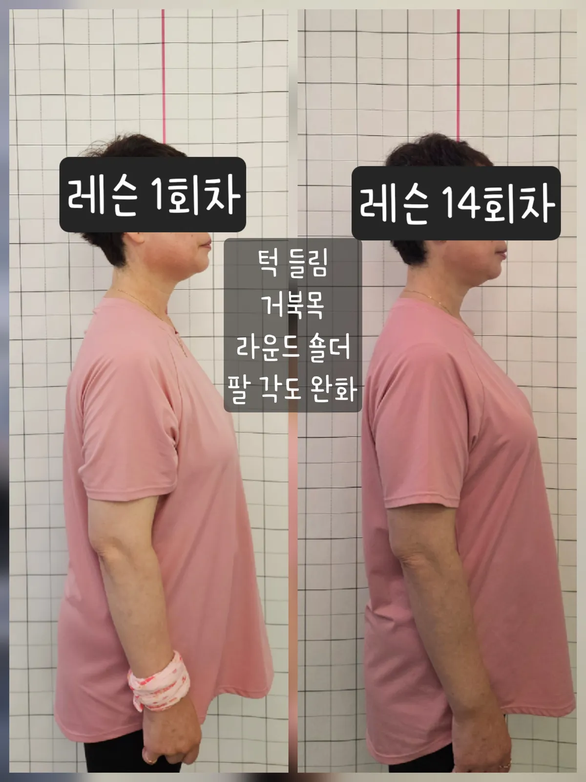 이미지 14