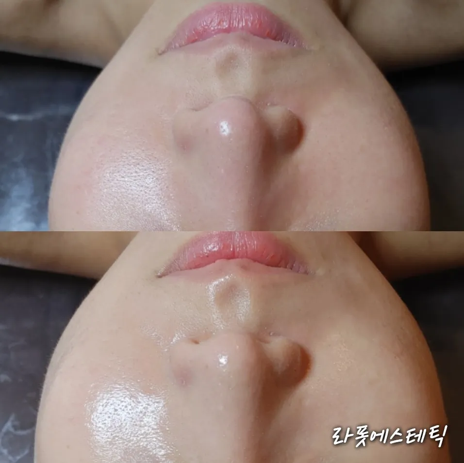이미지 8