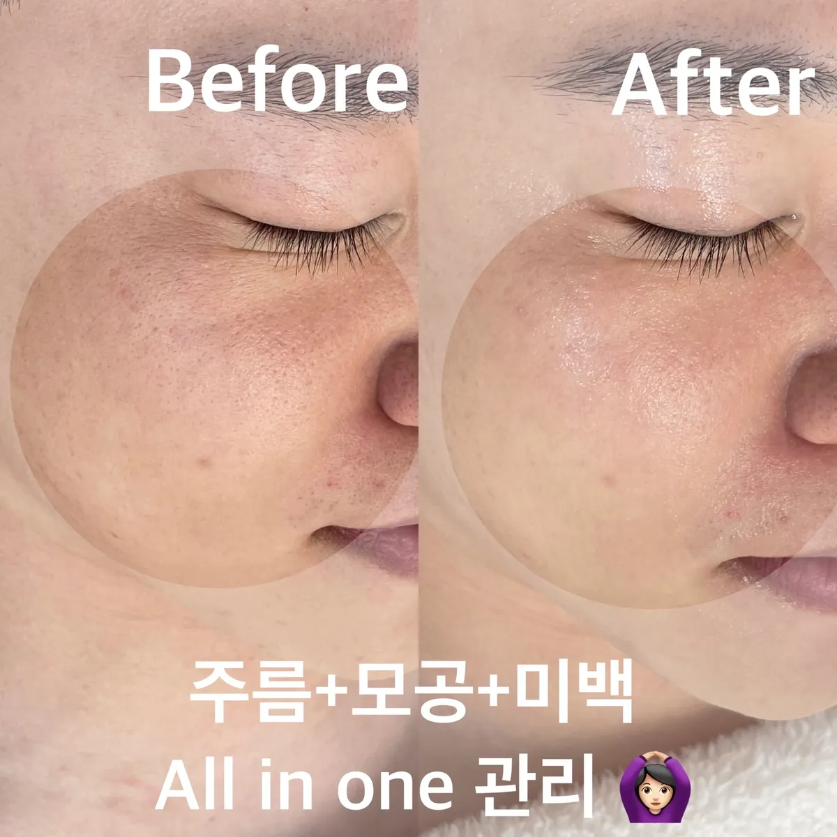 이미지 6