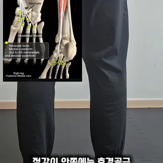 달릴 때 정강이 통증, 발목 탄성 강화로 해결하는 퍼스널 트레이닝