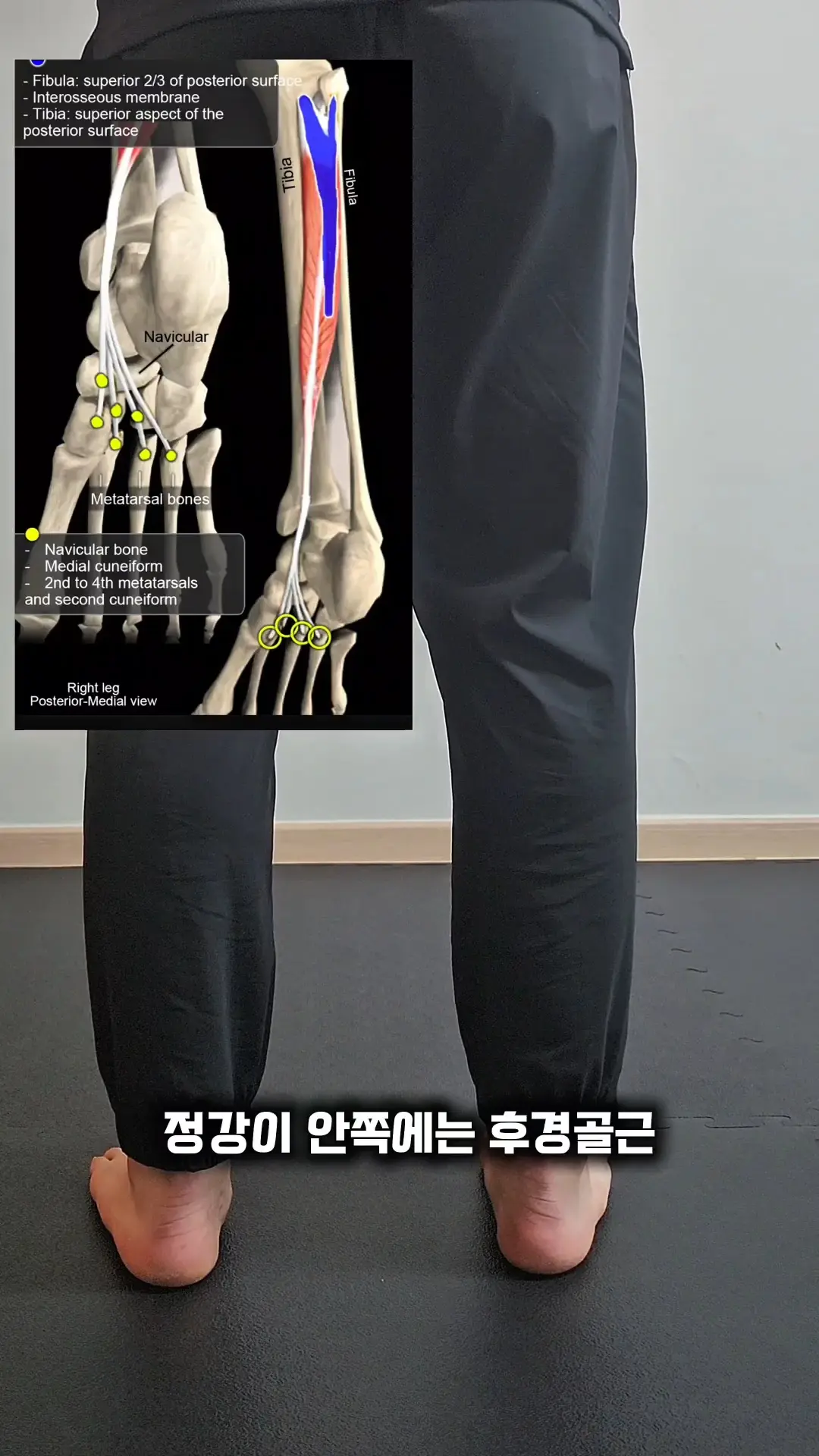이미지 4