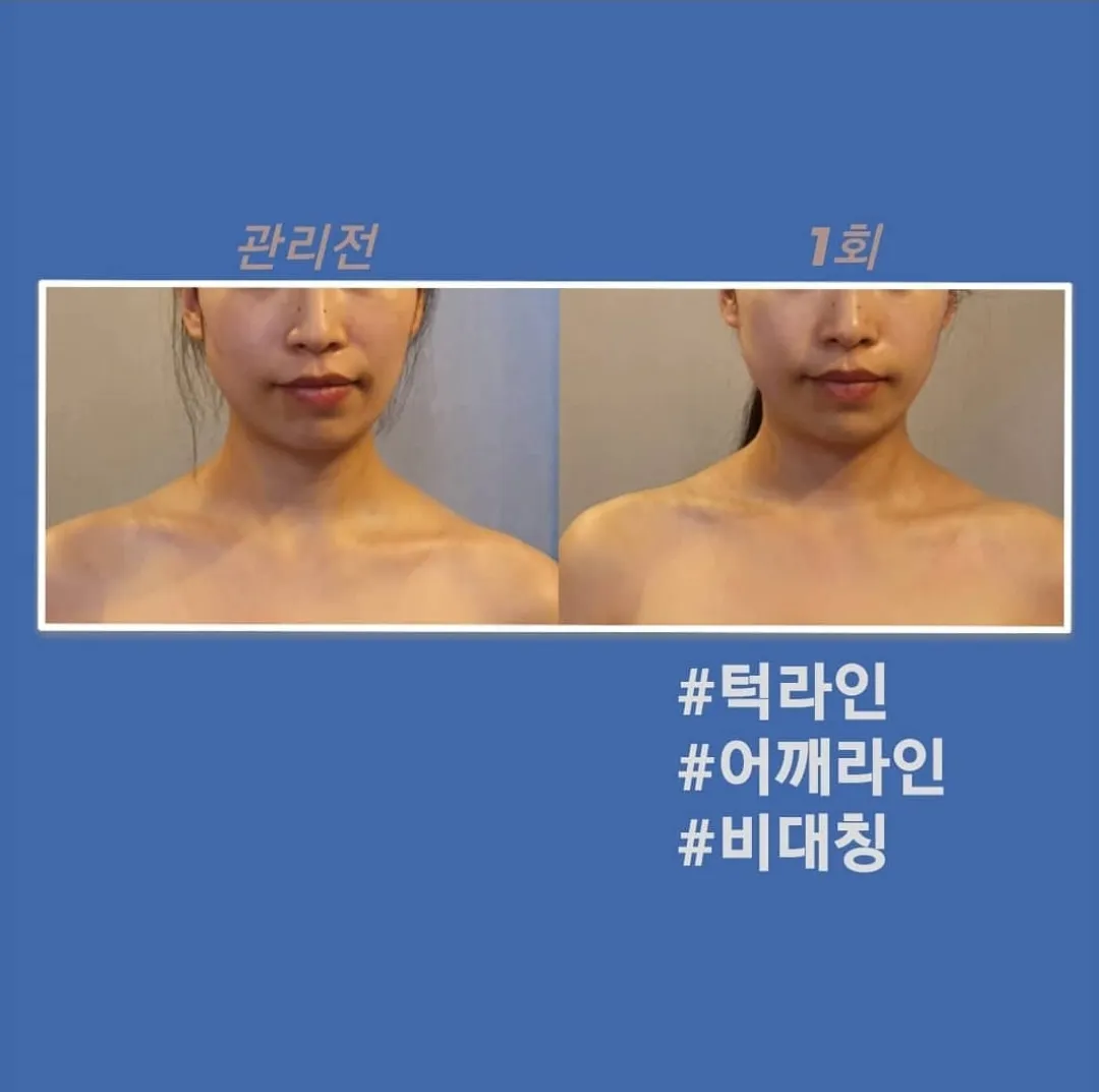 이미지 5