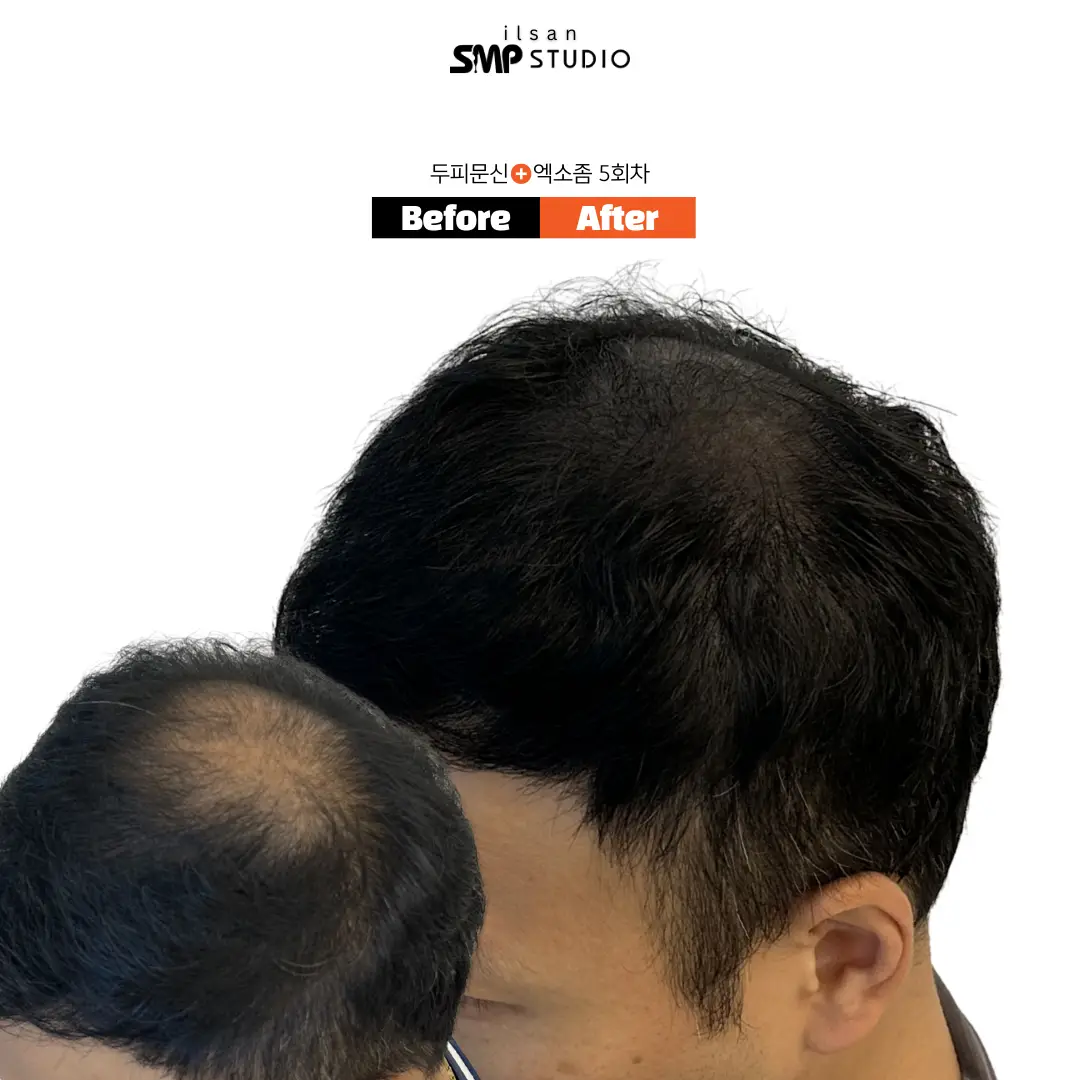 이미지 10