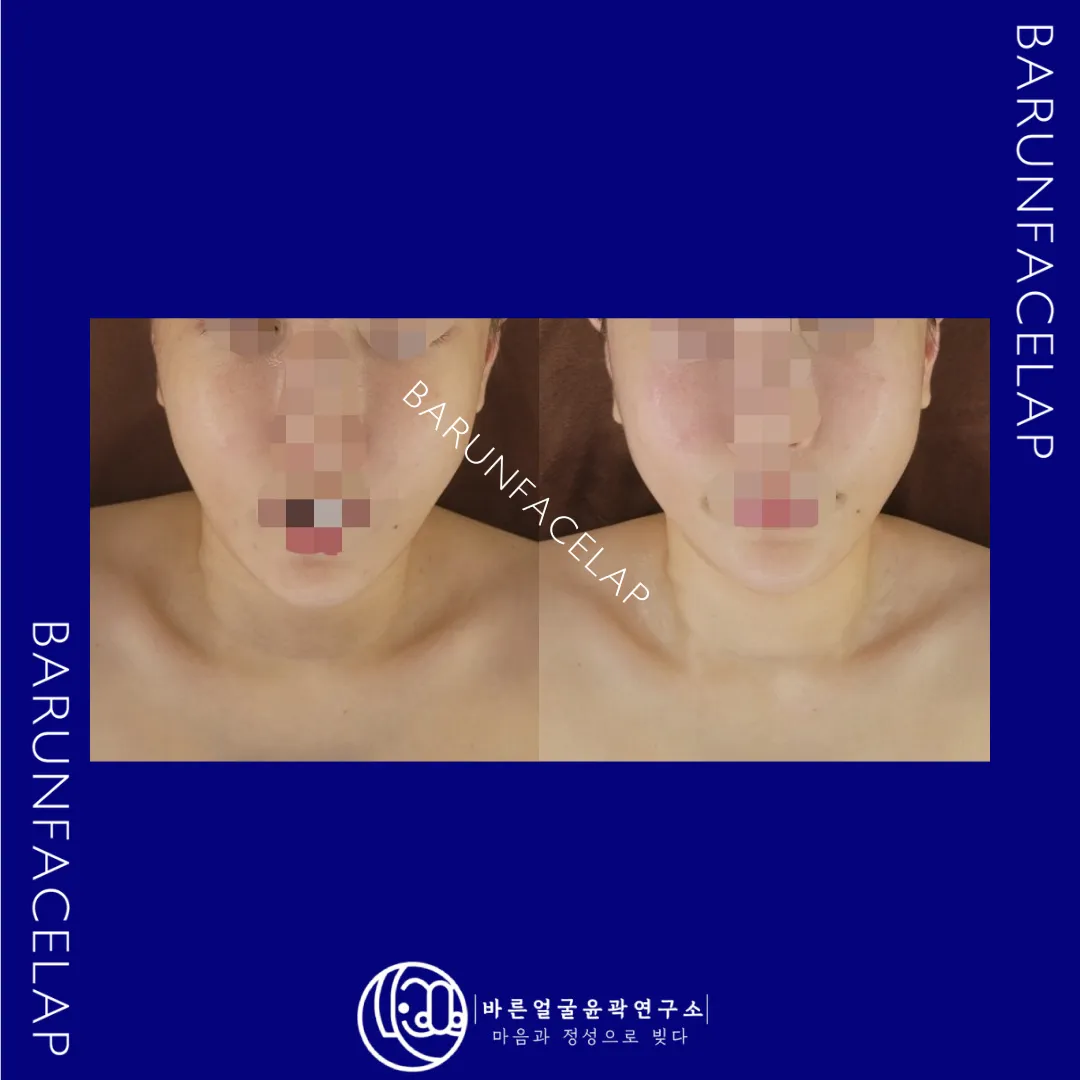 이미지 8