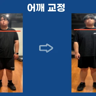 ❗체형교정❗