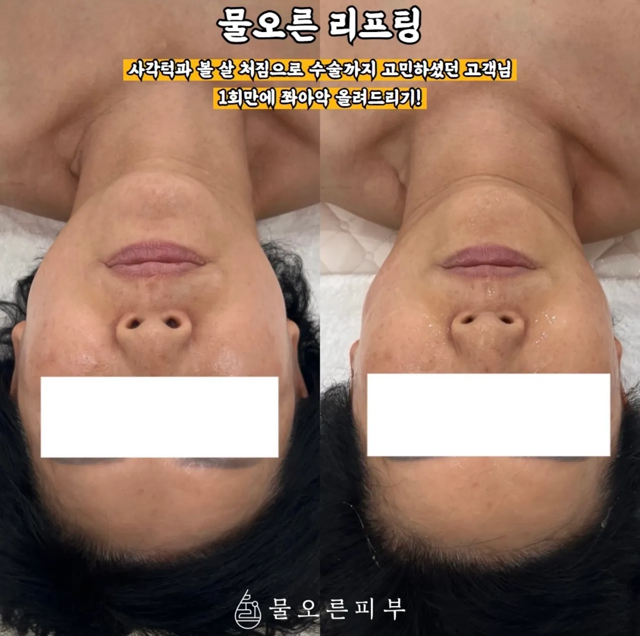 이미지 5