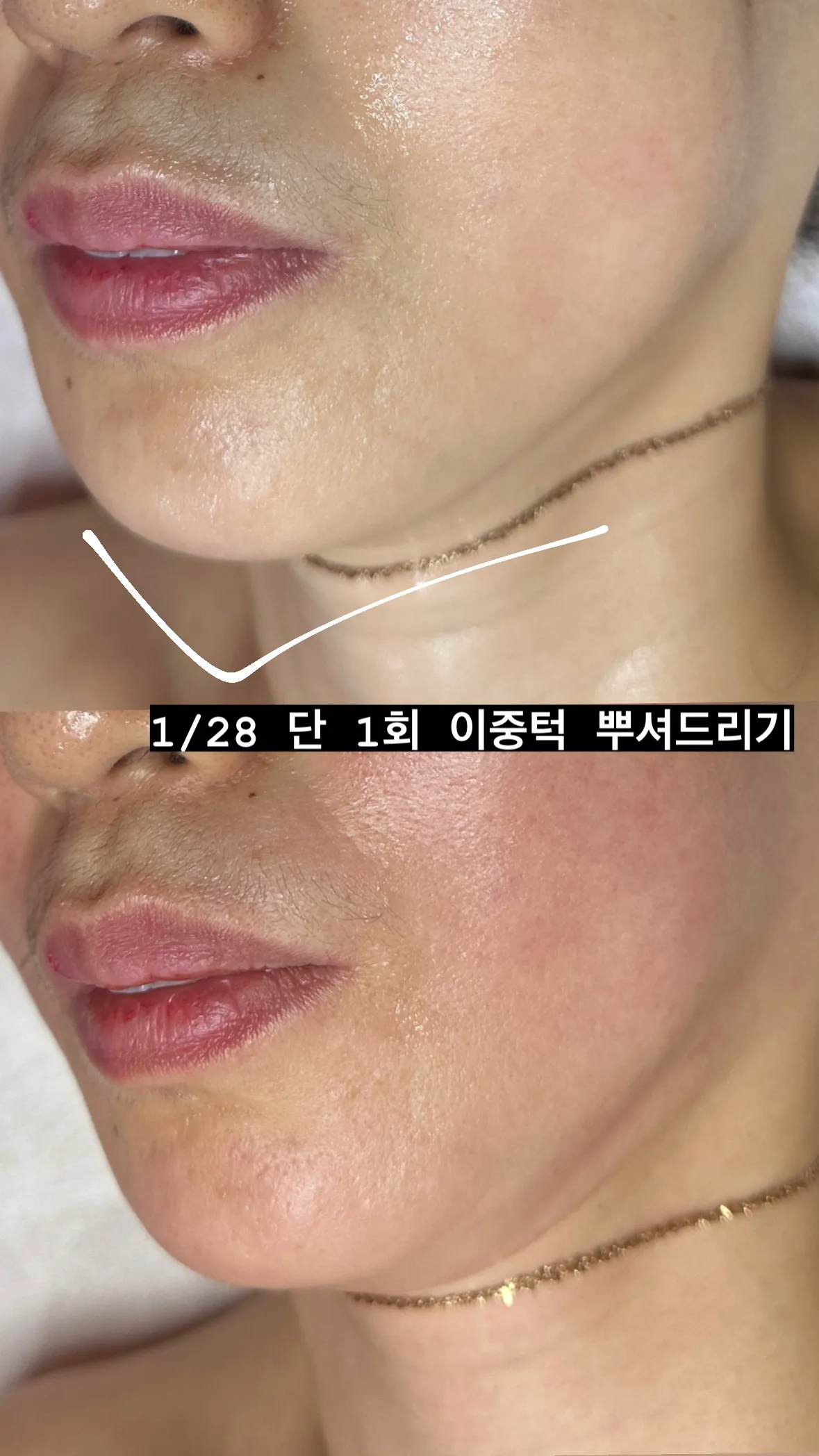 이미지 6