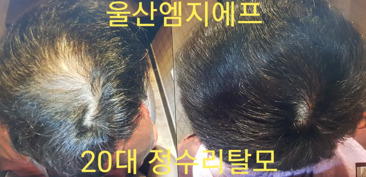 이미지 5