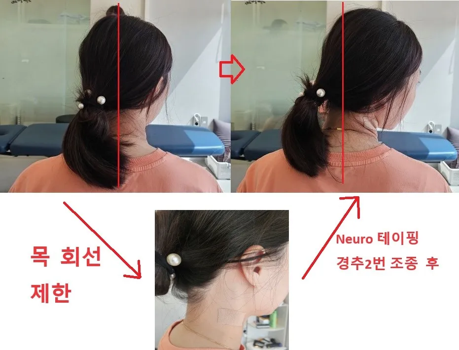 이미지 18