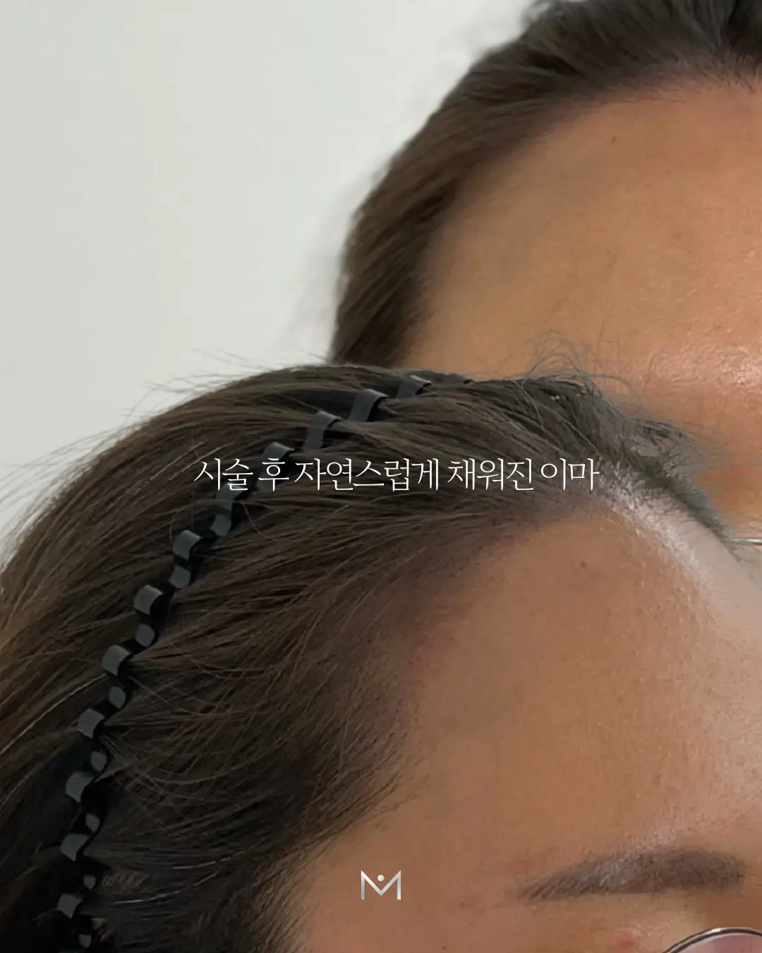 이미지 22