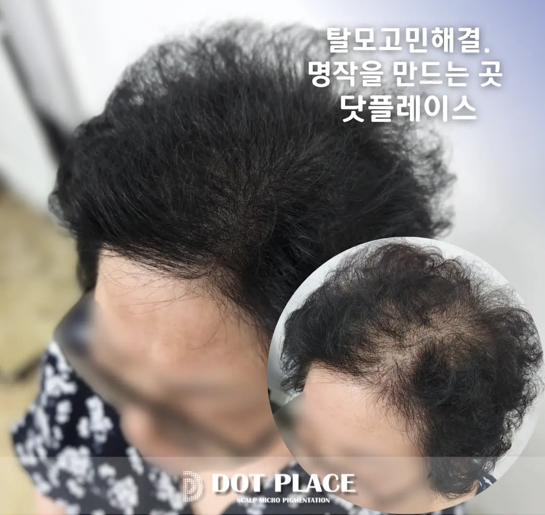 이미지 8
