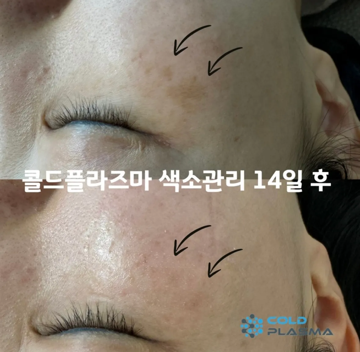 이미지 6