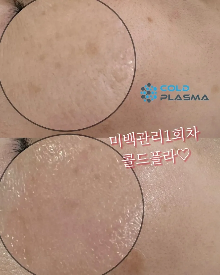 이미지 8