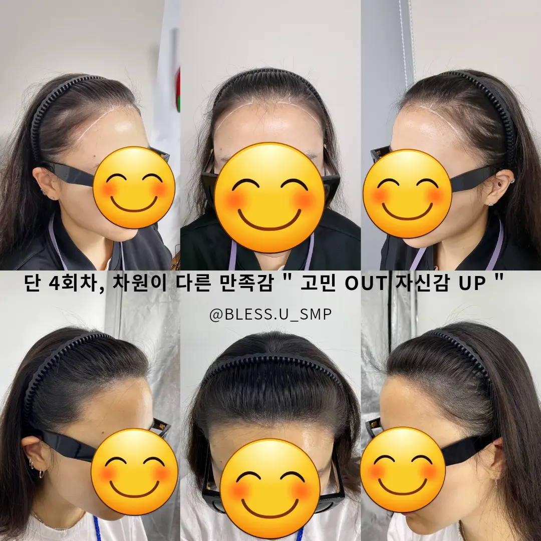 이미지 10