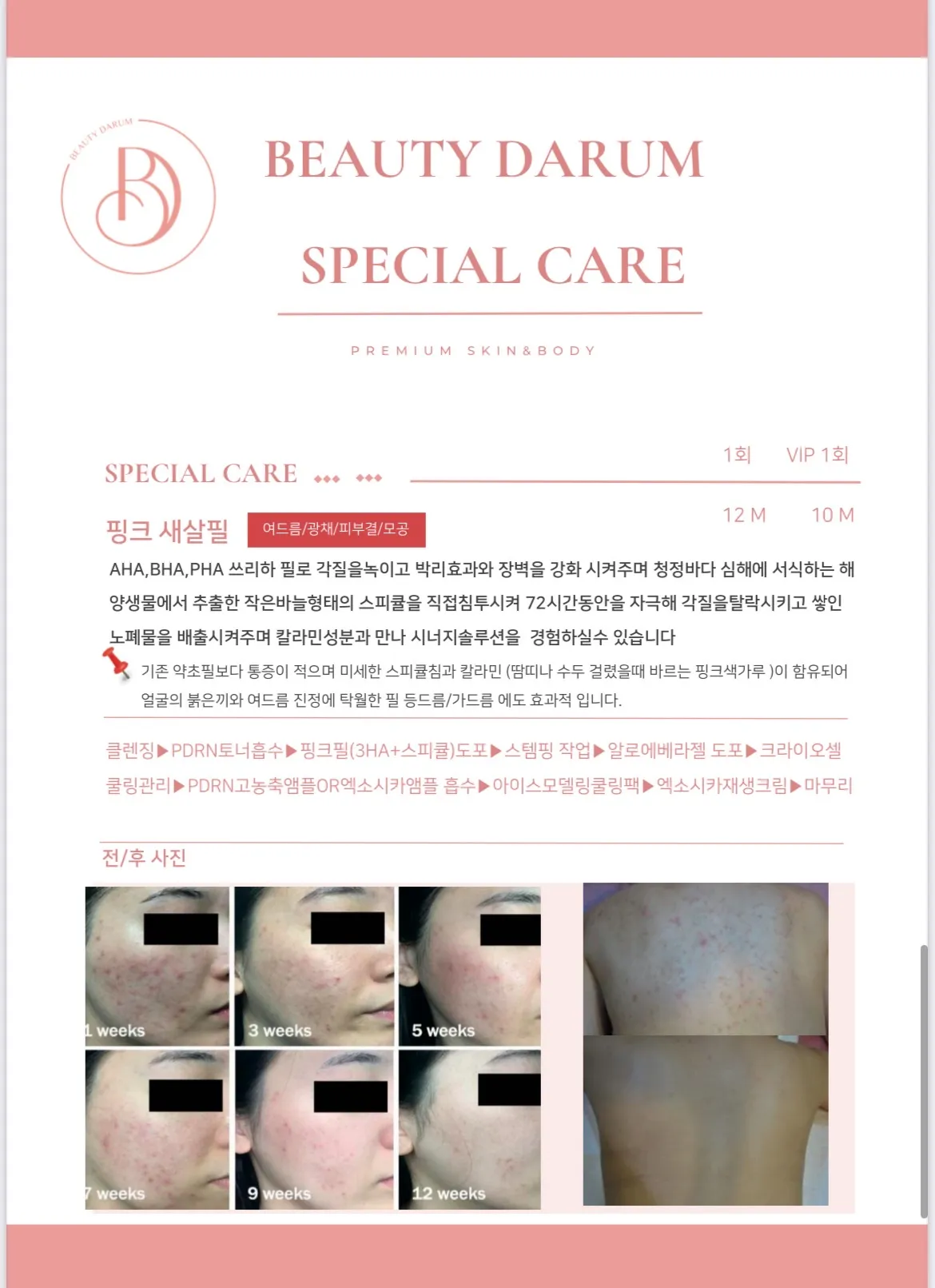 이미지 3