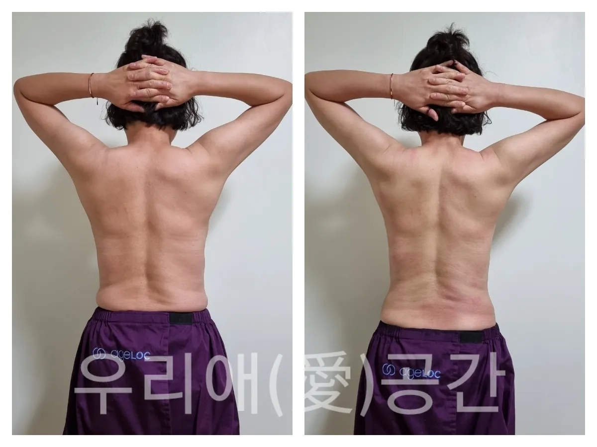 이미지 11