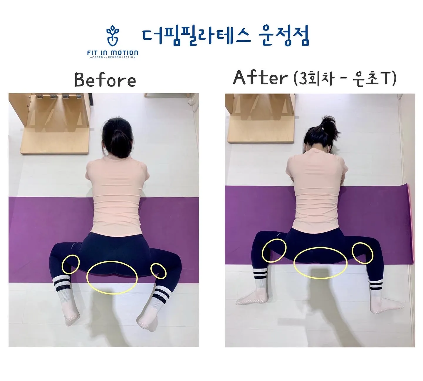 이미지 5