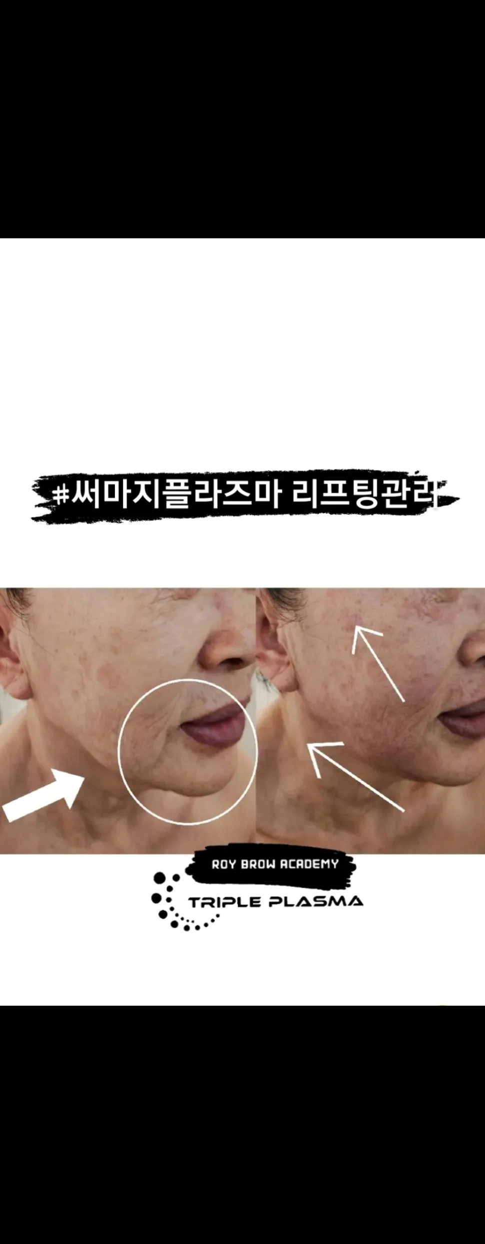이미지 12