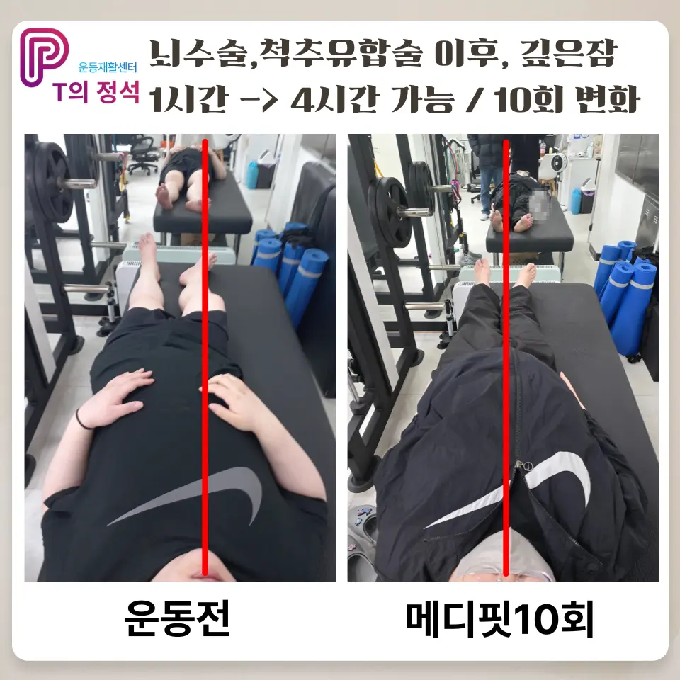 이미지 13