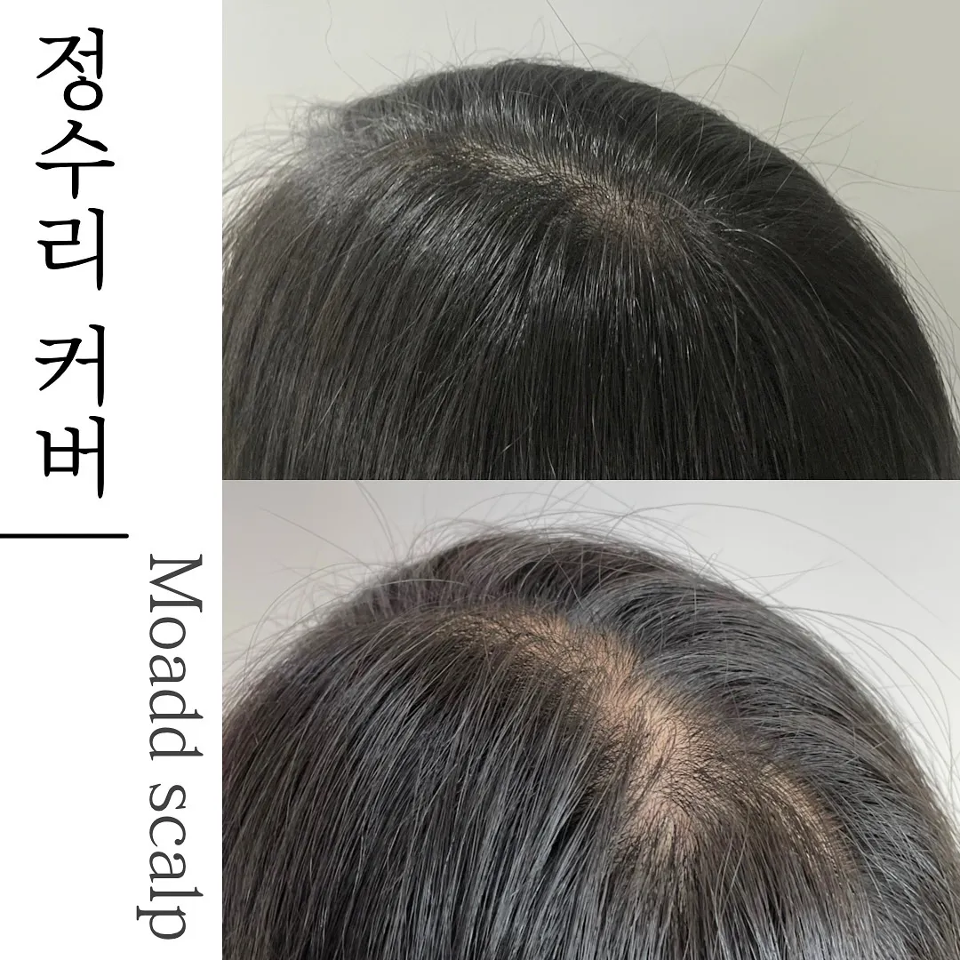 이미지 8