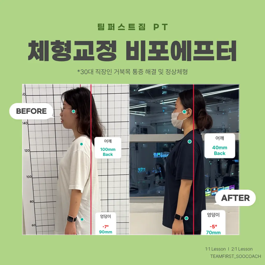 이미지 28