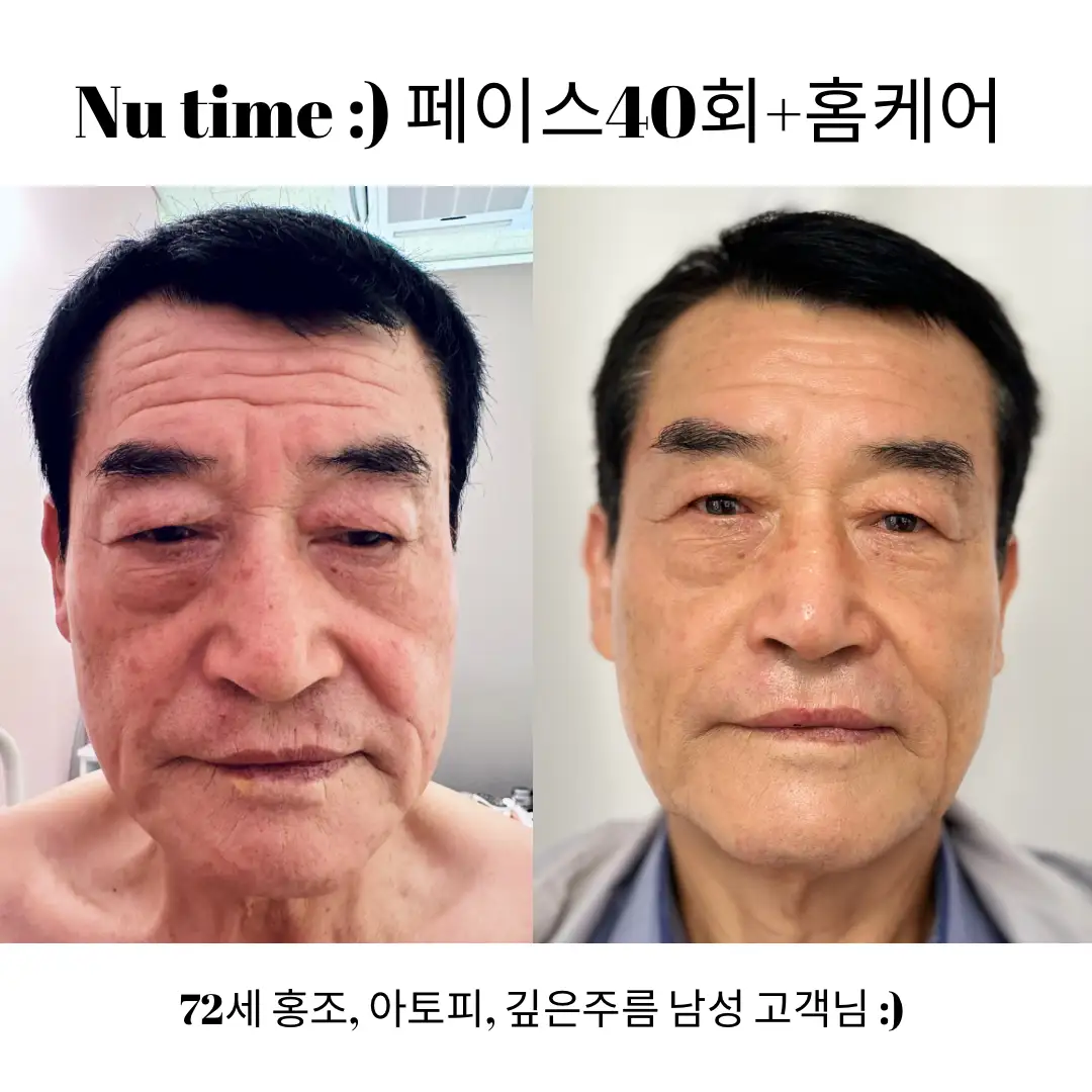 이미지 6