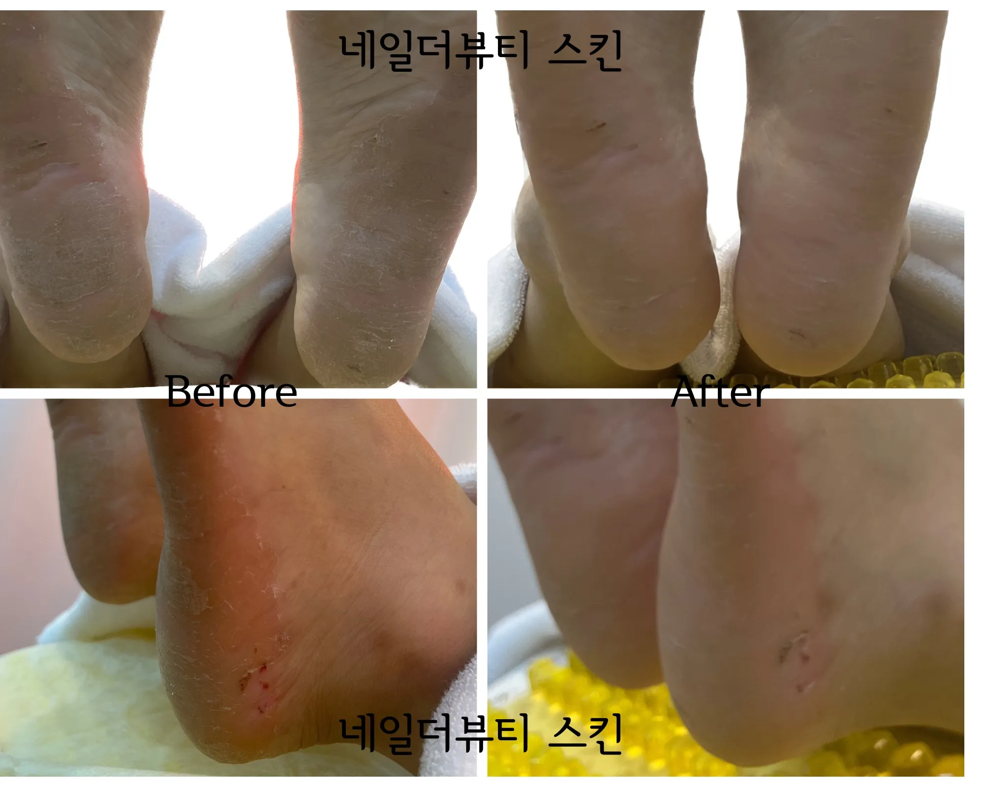 이미지 5