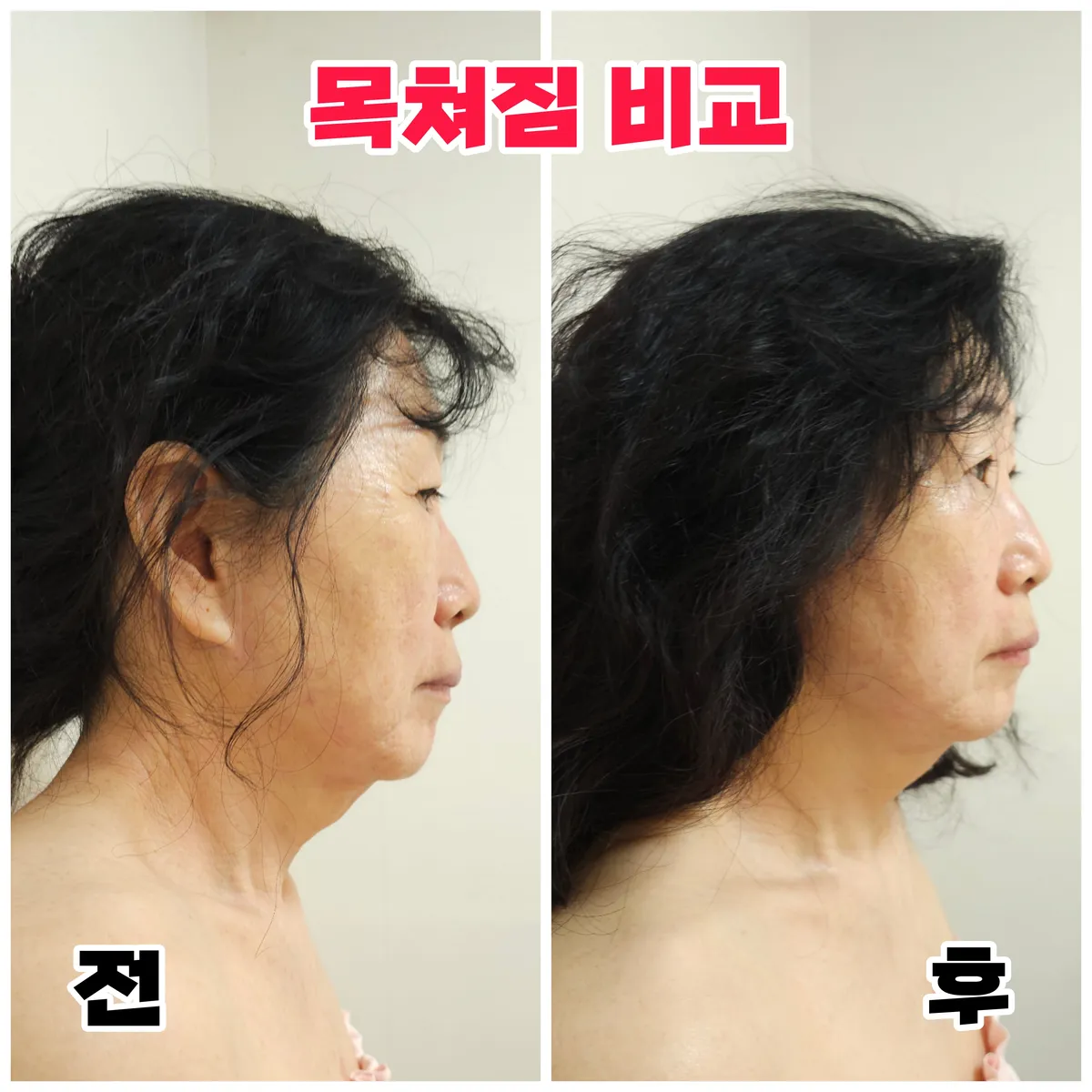 이미지 10