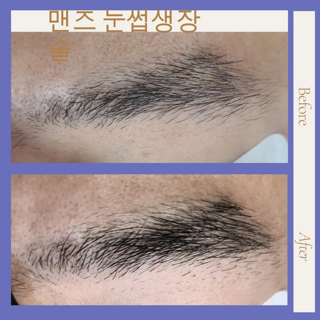 이미지 10