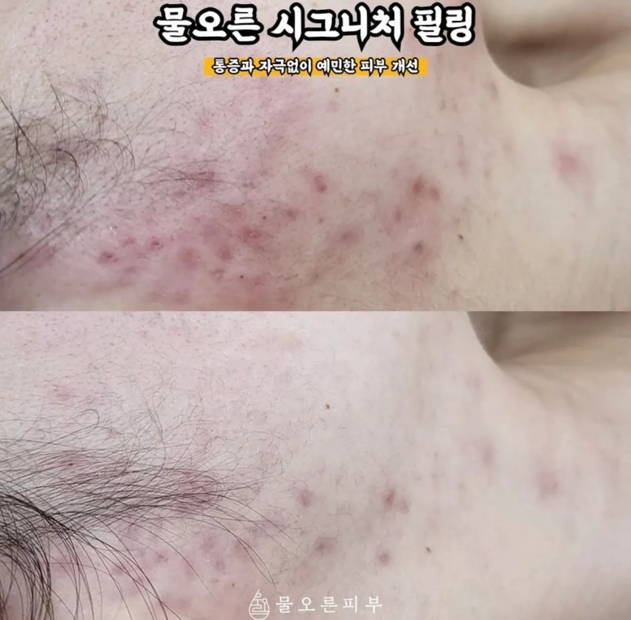 이미지 4