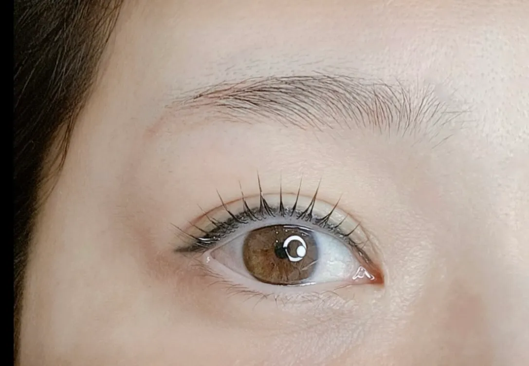 이미지 2