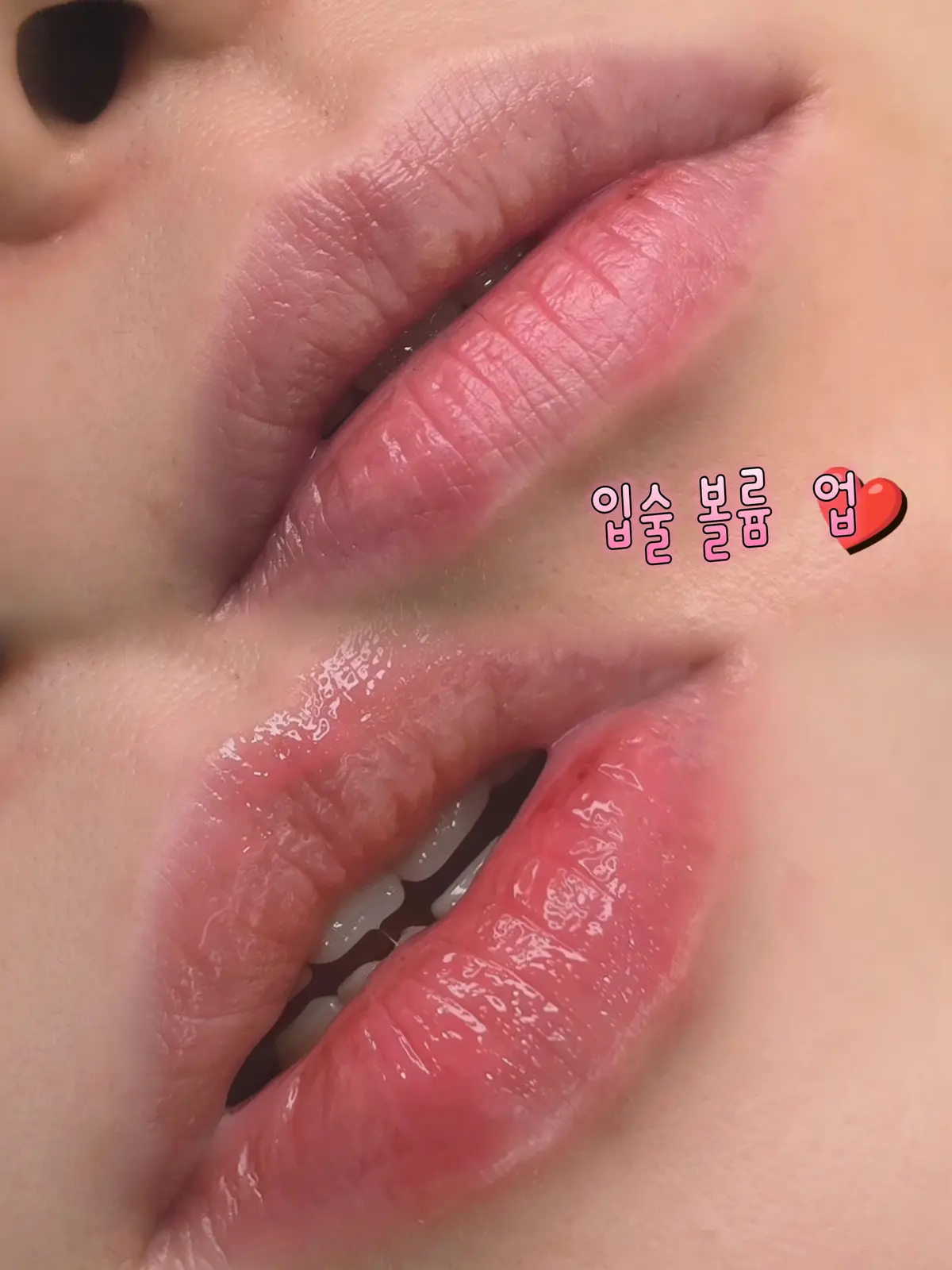 이미지 3