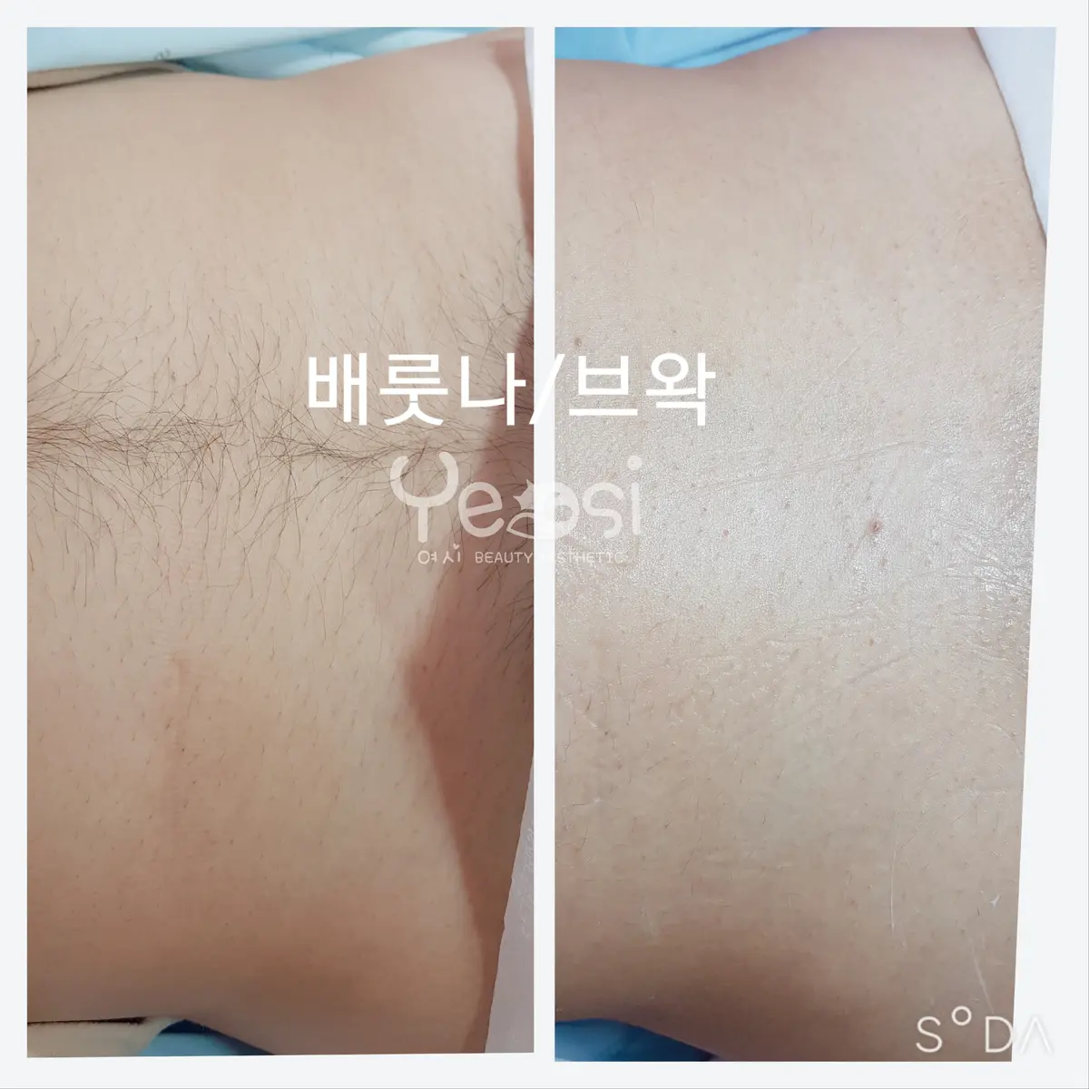 이미지 4
