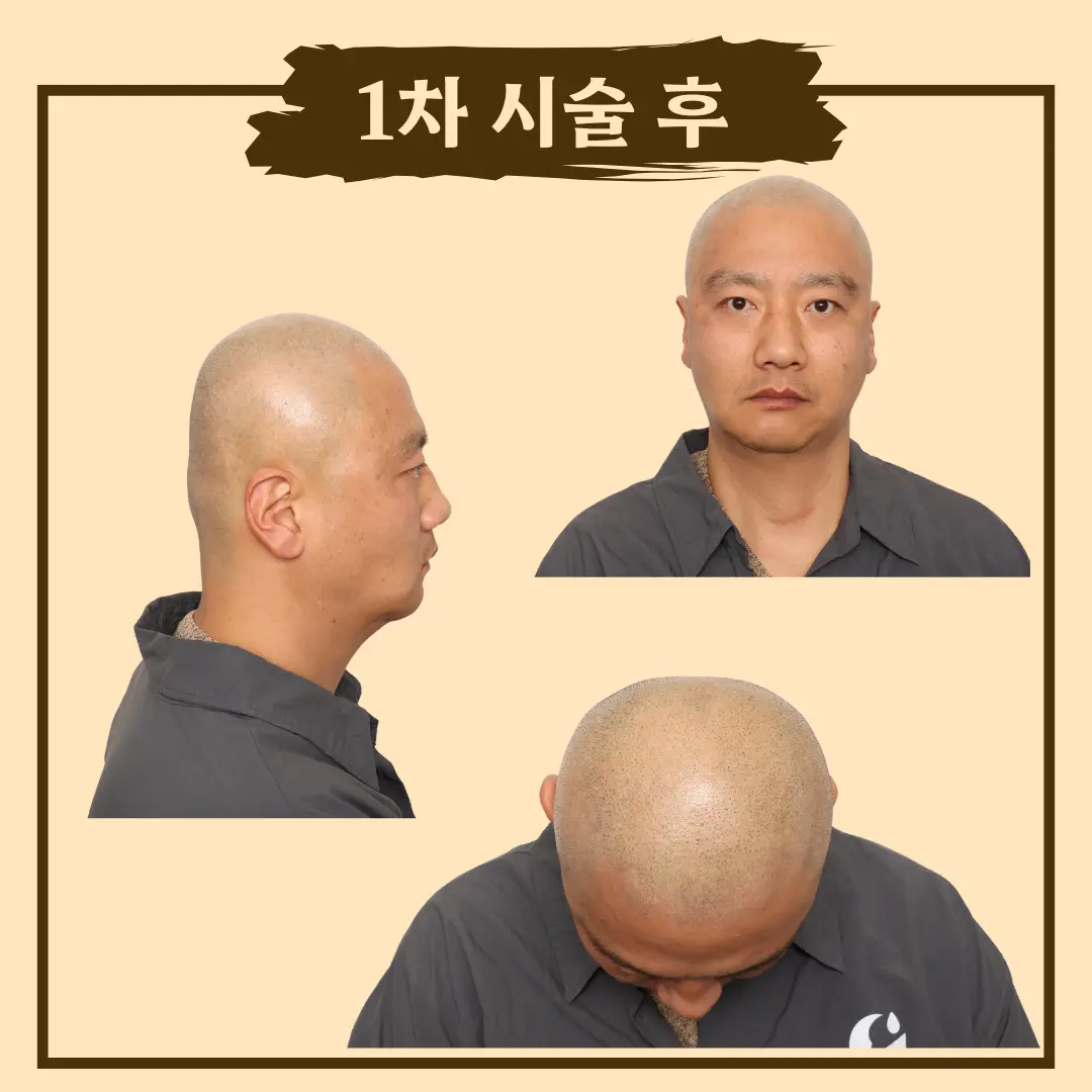 이미지 6