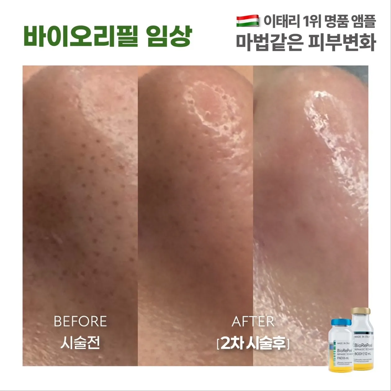 이미지 5