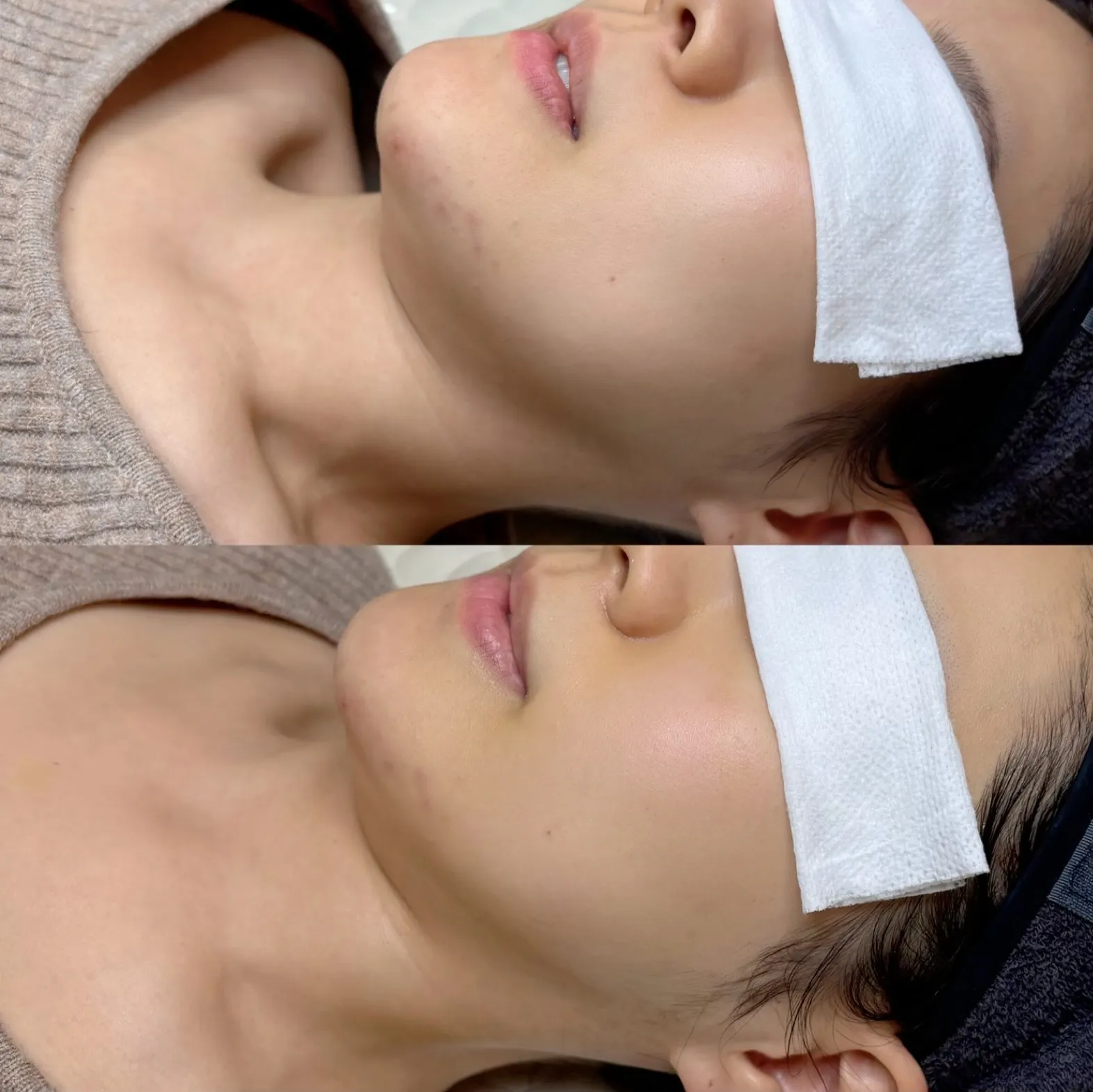 이미지 4
