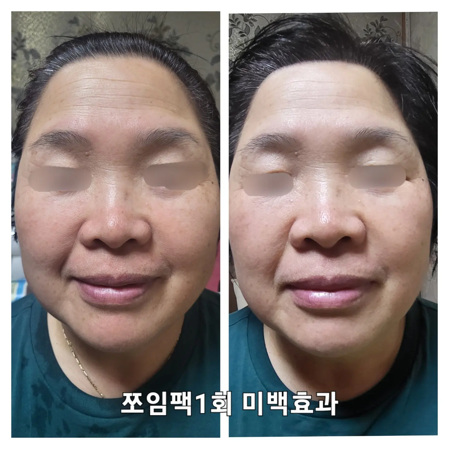 이미지 7