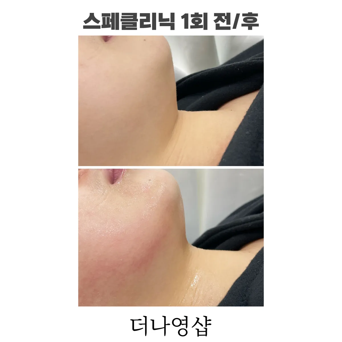 이미지 5
