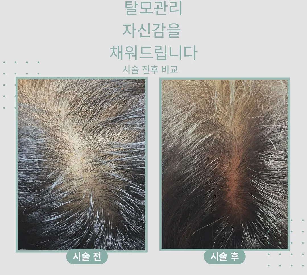 이미지 9