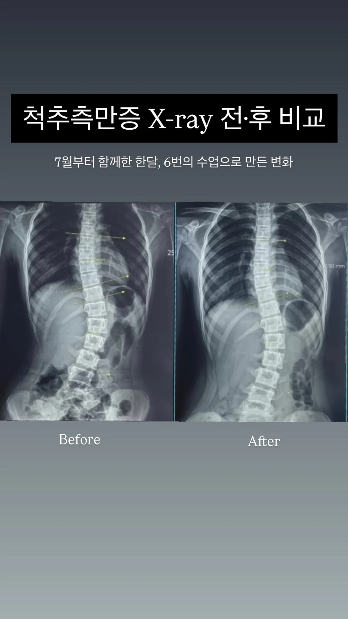 이미지 6