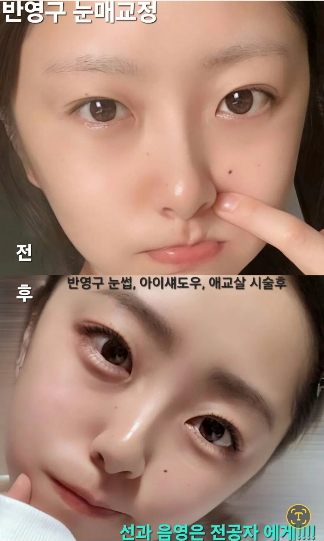 이미지 11