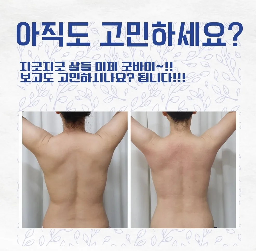 이미지 5