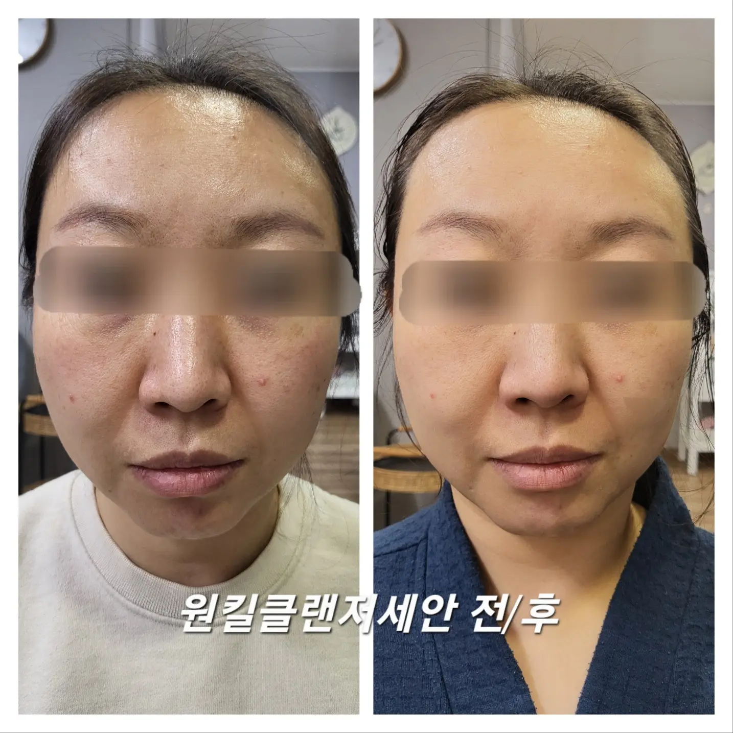 이미지 6