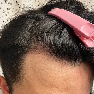 SMP 작업